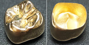 ゴールドクラウン