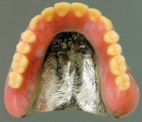 金属床（コバルトクロム）