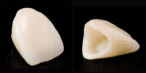 キャスタブルセラミック